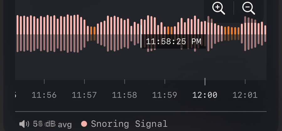 Zoomed-in waveform with dusty rose snoring bars, faded gray silence, and the Snoring Signal legend